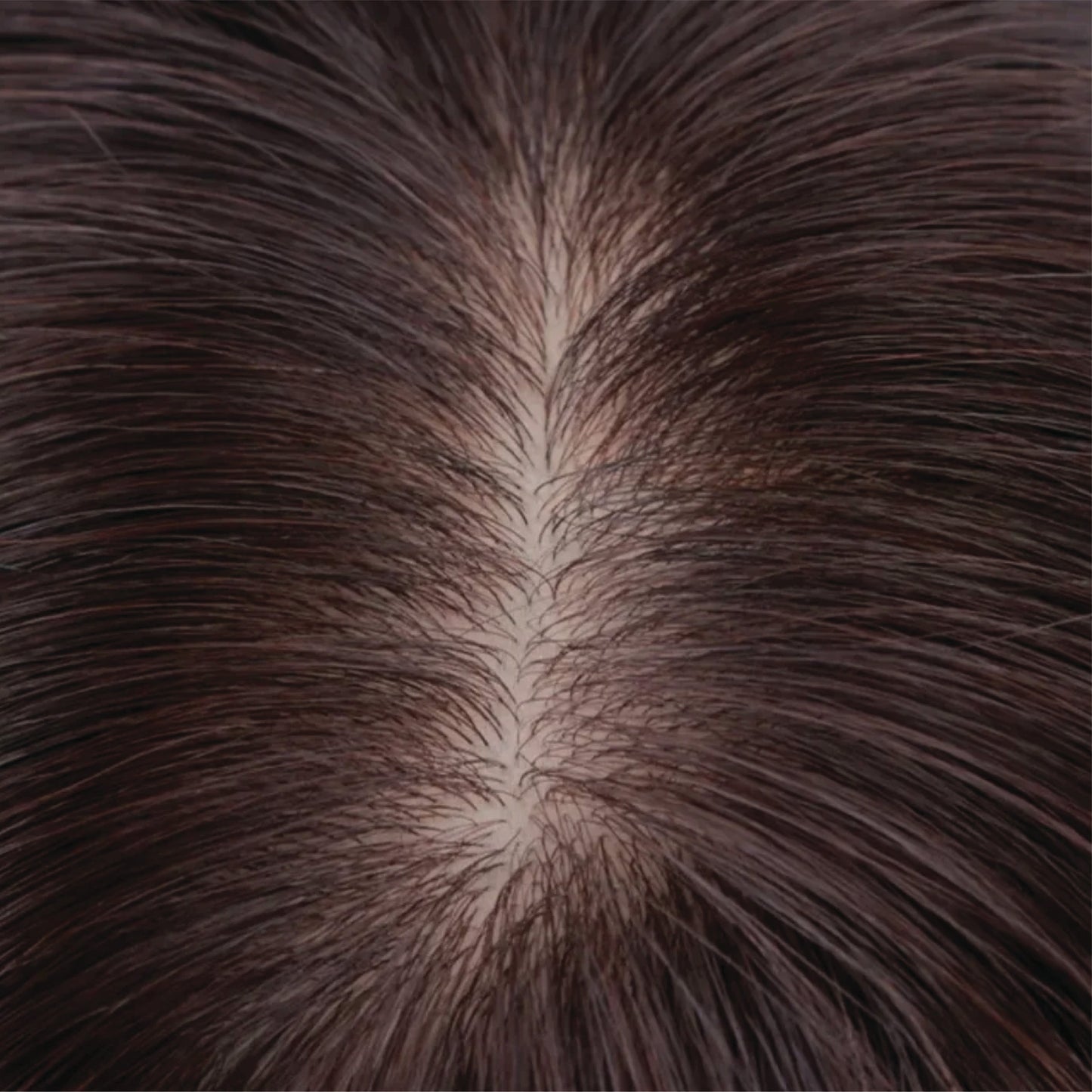 💨Last Day:84% Off🔥Silk Base Human Hair Topper